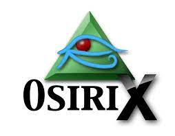 OsiriX MD